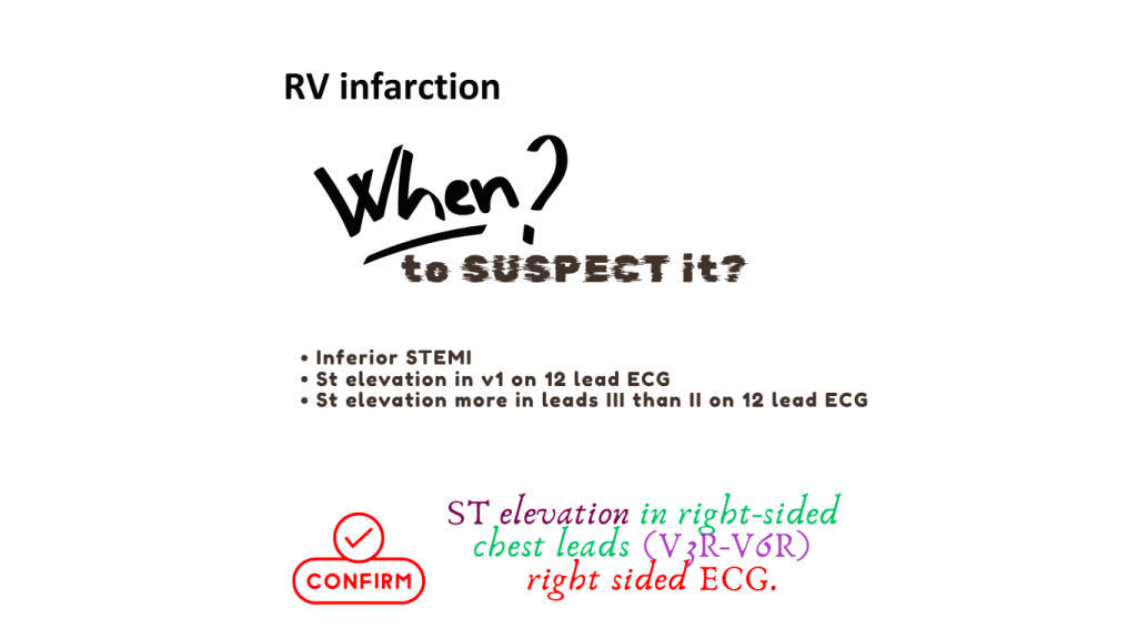 Infographic on RV infarction, highlighting signs to suspect it: inferior STEMI, ST elevation in v1, and greater ST elevation in lead III than II on 12 lead ECG. Includes note to confirm with right-sided ECG.