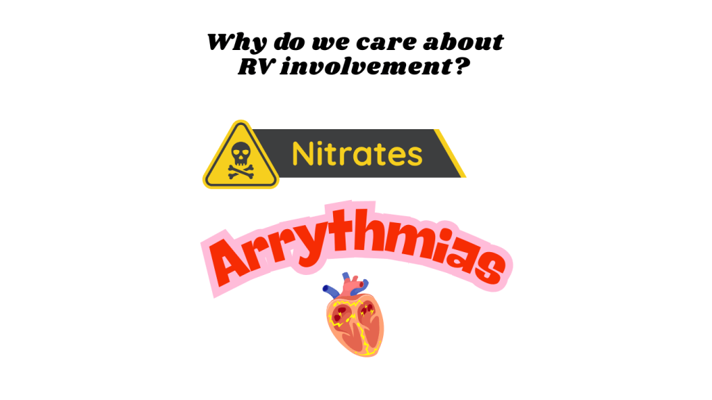 Image illustrating the importance of Right Ventricular (RV) involvement in myocardial infarctions, featuring the words 'Nitrates' with a caution sign and 'Arrhythmias' alongside a graphic of a heart.