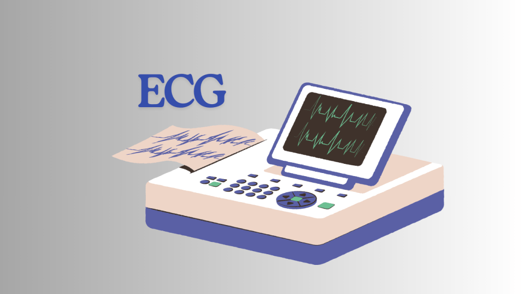 Illustration of an ECG machine displaying heart rhythm, with a printed ECG graph beside it.