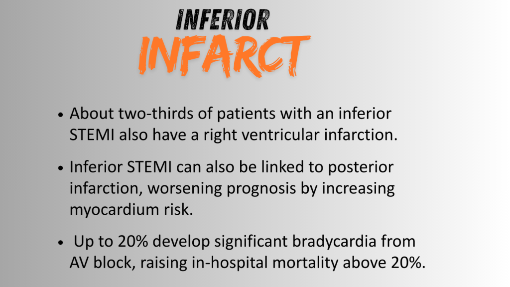 Text explaining inferior infarct and its implications for patients with STEMI.