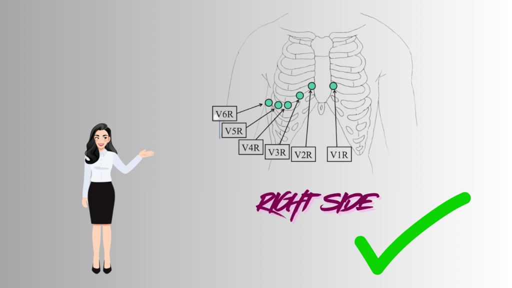 An illustration showing the proper placement of ECG leads on the right side of a human chest with a woman pointing to the diagram.