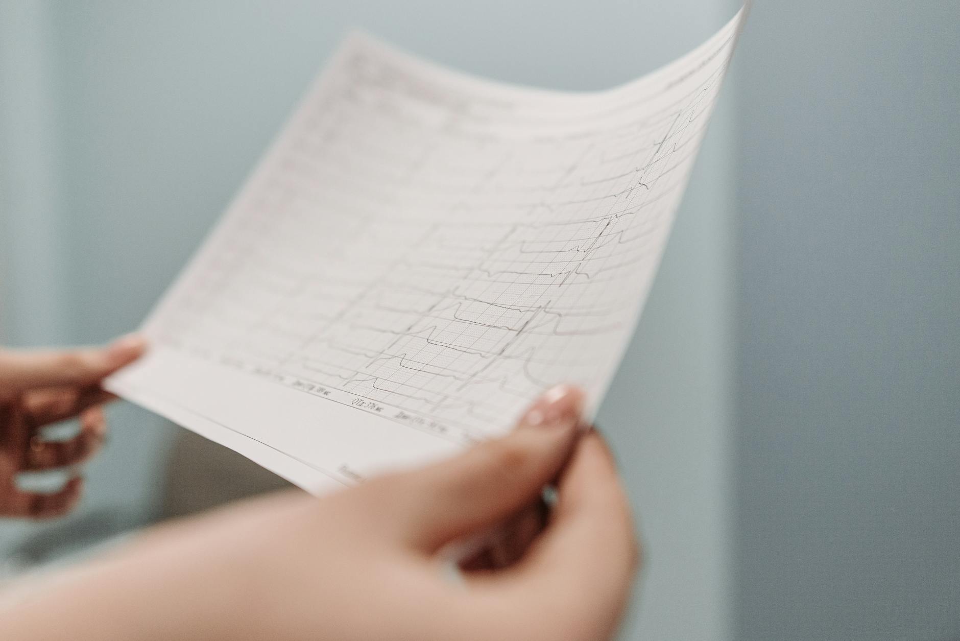 close up shot of a person holding a electrocardiogram result